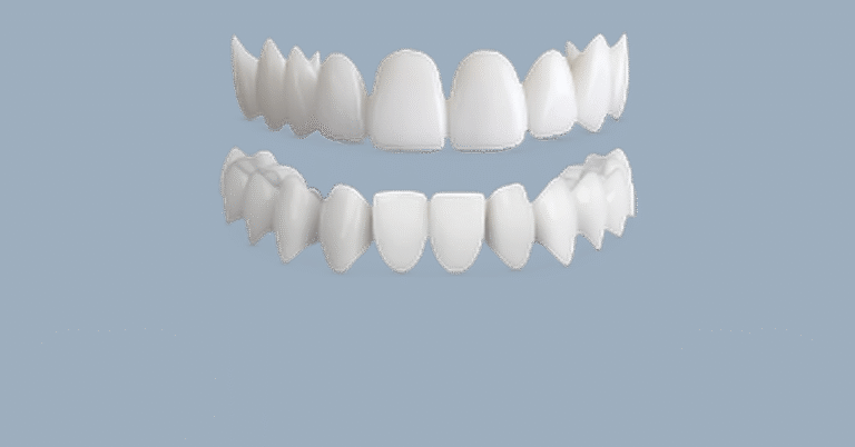 Shiny Smile Veneers Review