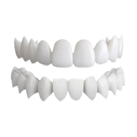 Shiny Smile Veneers Review